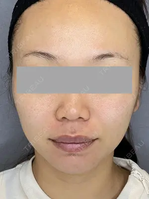 before image