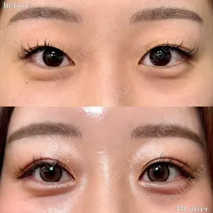 before image