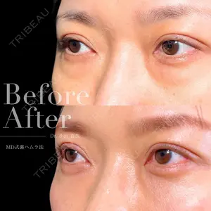 90 days after image