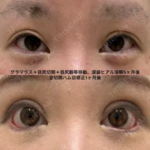 before image