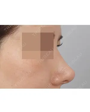 30 days after image
