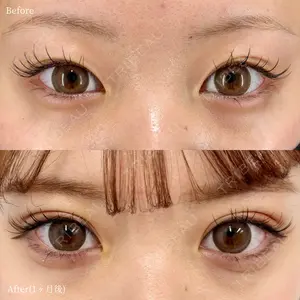 before image