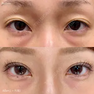 before image