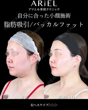 180 days after image