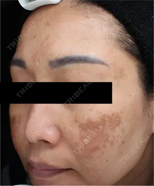 before image