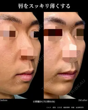 before image