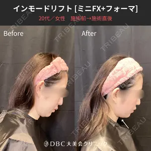 before image