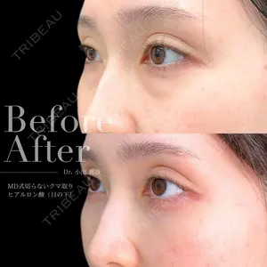 30 days after image