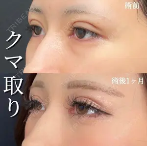 28 days after image
