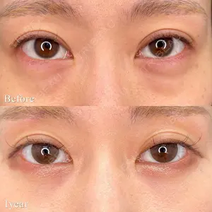 before image