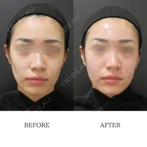 0 days after image