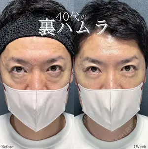 7 days after image
