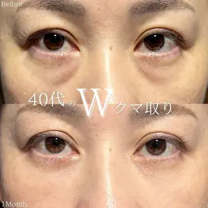 7 days after image