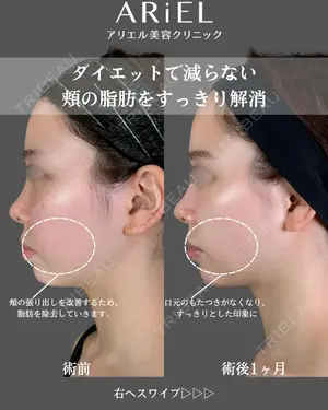 90 days after image