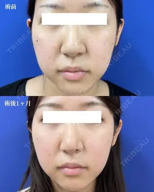 before image
