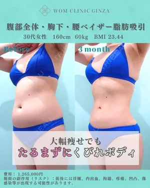 90 days after image