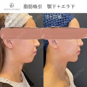 60 days after image