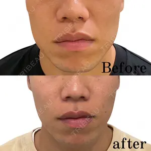 35 days after image