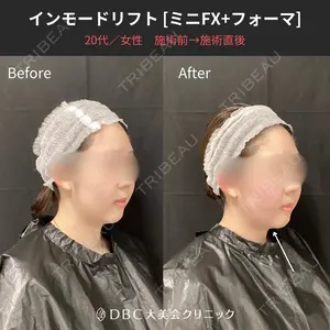 null days after image