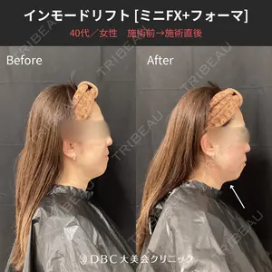 null days after image