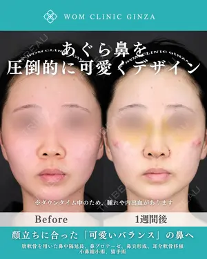 before image