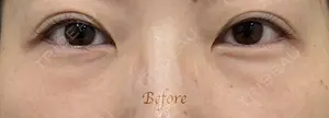 before image