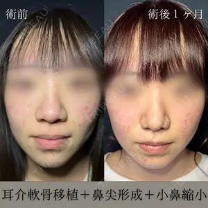 before image