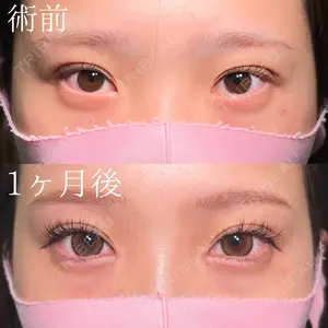 before image