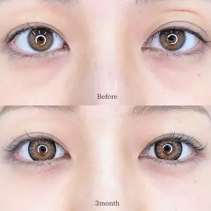 before image