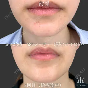 before image