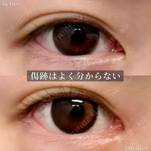 before image