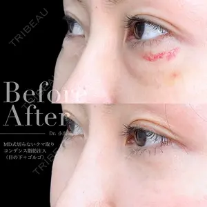 90 days after image