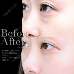 90 days after image