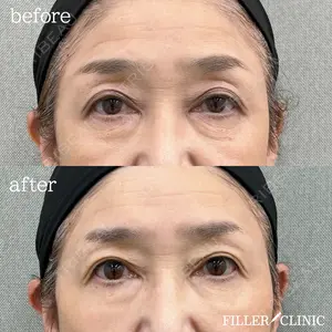 null days after image