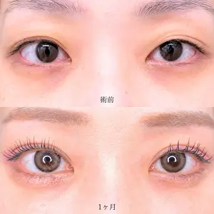 30 days after image