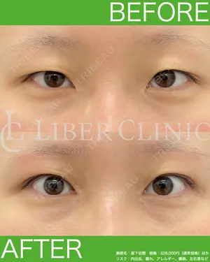 before image