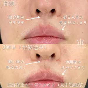 before image