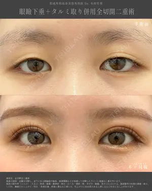 180 days after image