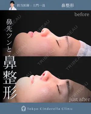 before image