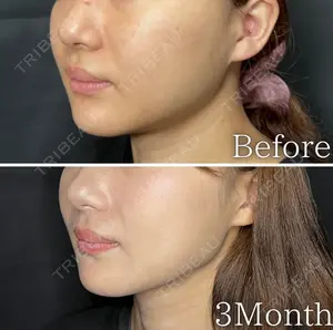 90 days after image