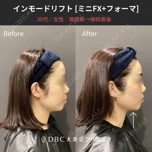 before image