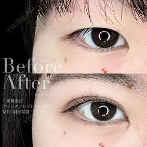 30 days after image