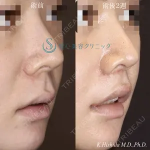 before image