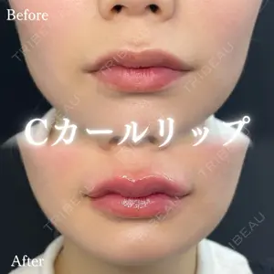 before image