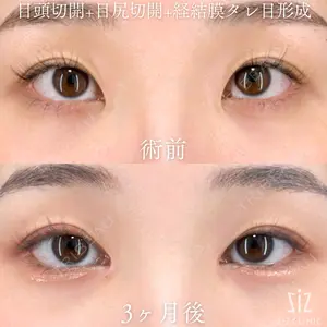 before image