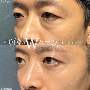 before image