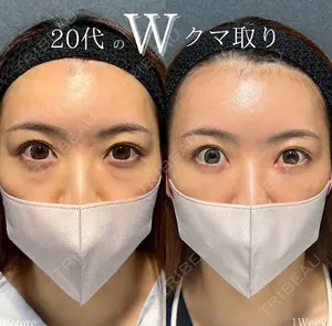 30 days after image