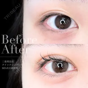 90 days after image