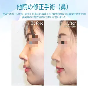 before image