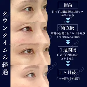 30 days after image